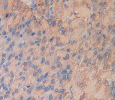 Polyclonal Antibody to Insulin Receptor Related Receptor (INSRR)