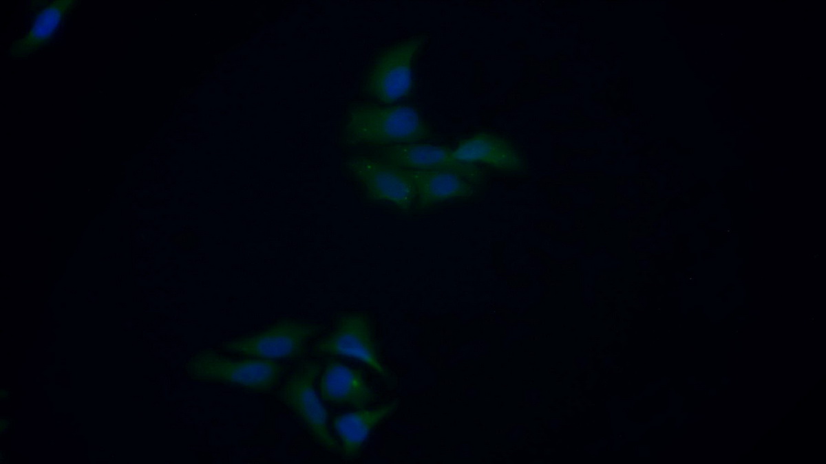 Polyclonal Antibody to Dipeptidyl Peptidase 3 (DPP3)