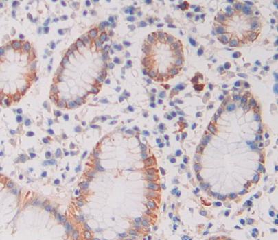 Polyclonal Antibody to Calcyon Neuron Specific Vesicular Protein (CALY)