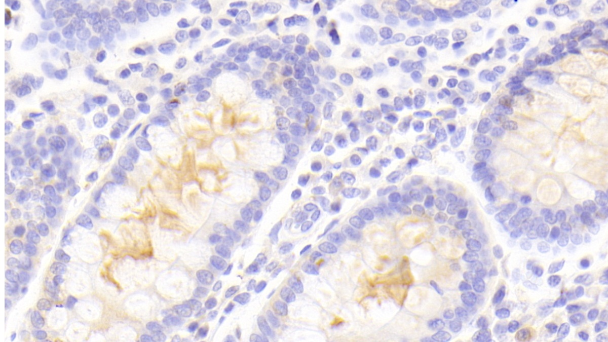 Polyclonal Antibody to Perilipin 4 (PLIN4)