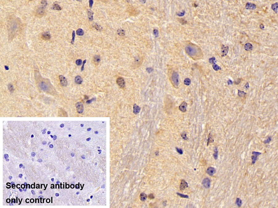 Polyclonal Antibody to Peptidyl Prolyl Cis/Trans Isomerase NIMA Interacting Protein 1 (PIN1)