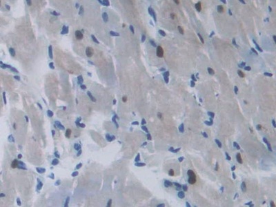 Polyclonal Antibody to C-Ros Oncogene 1, Receptor Tyrosine Kinase (ROS1)