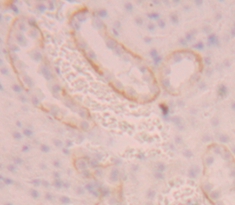 Polyclonal Antibody to Solute Carrier Family 3, Member 2 (SLC3A2)