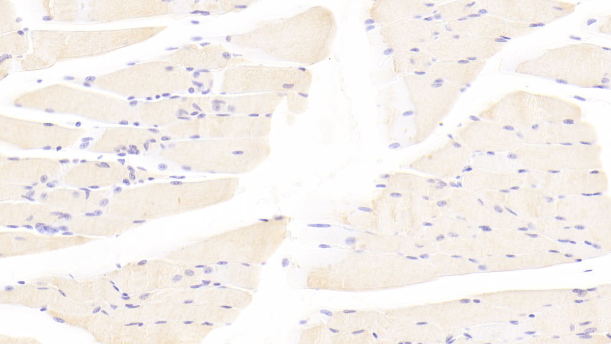 Polyclonal Antibody to Tafazzin (TAZ)