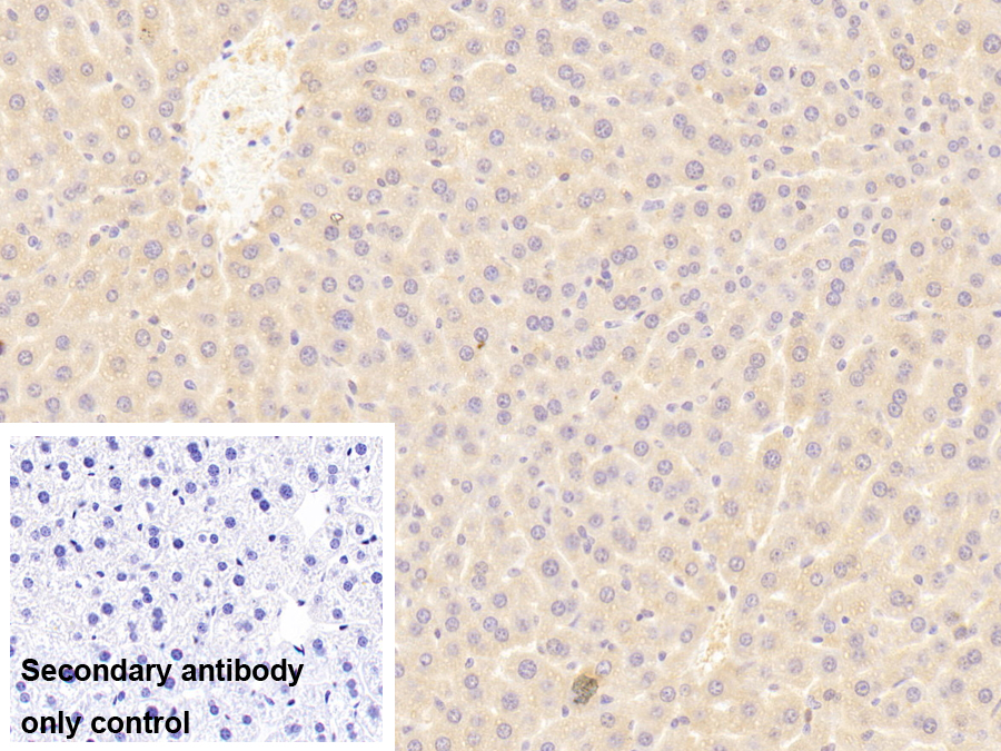 Polyclonal Antibody to Alpha-1-B-Glycoprotein (a1BG)