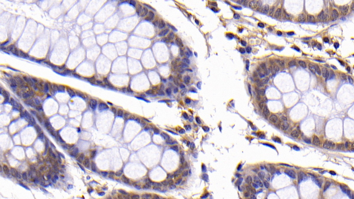 Polyclonal Antibody to B-Cell CLL/Lymphoma 2 Like Protein (Bcl2L)