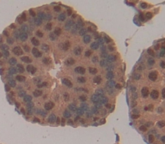 Polyclonal Antibody to Cyclin Dependent Kinase Inhibitor 1A (CDKN1A)