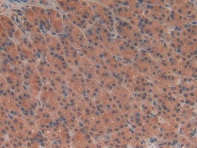 Polyclonal Antibody to Tubulin Delta (TUBd)