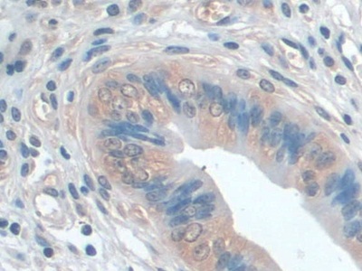 Polyclonal Antibody to Interleukin 22 Receptor Alpha 2 (IL22Ra2)