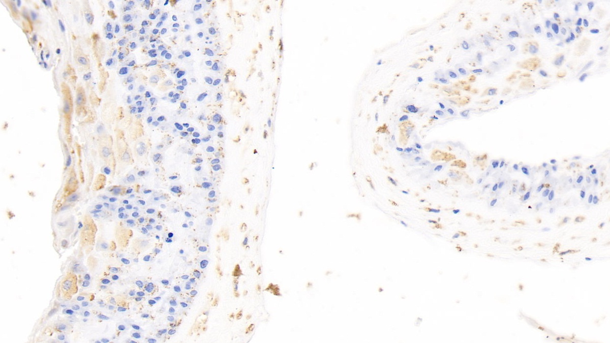 Polyclonal Antibody to Annexin A4 (ANXA4)