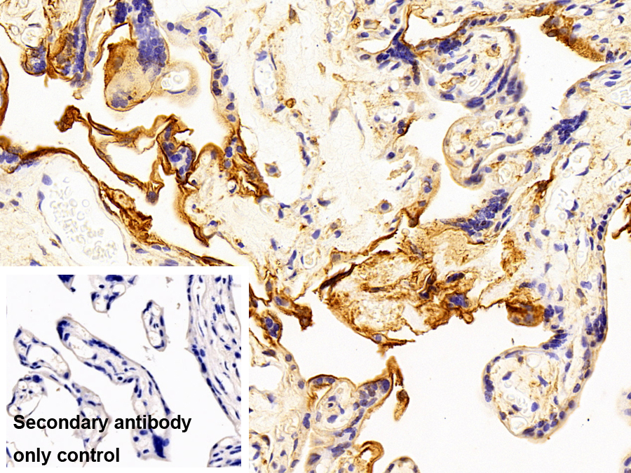 Polyclonal Antibody to Annexin A4 (ANXA4)