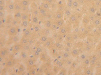 Polyclonal Antibody to Aldehyde Dehydrogenase 7 Family, Member A1 (ALDH7A1)