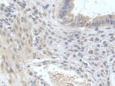 Polyclonal Antibody to Aldehyde Dehydrogenase 9 Family, Member A1 (ALDH9A1)