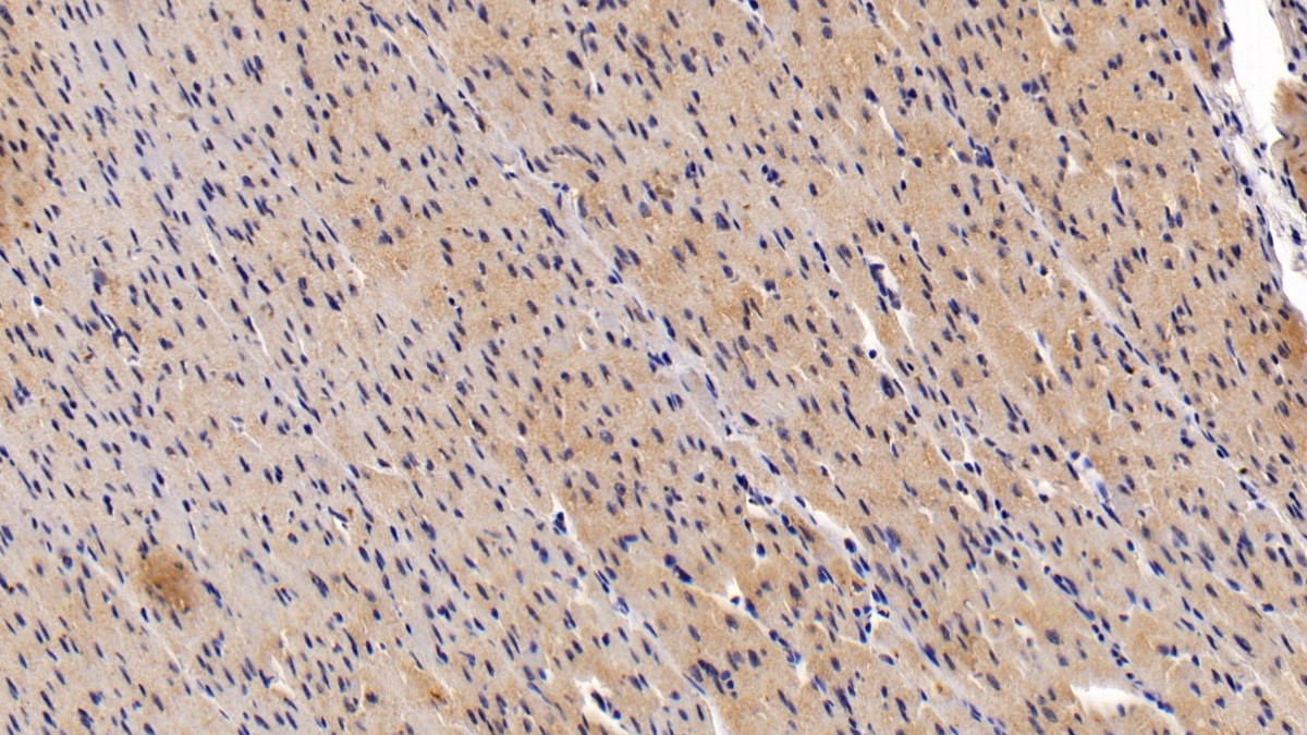 Polyclonal Antibody to Inositol-1,4,5-Trisphosphate Receptor Type 2 (ITPR2)