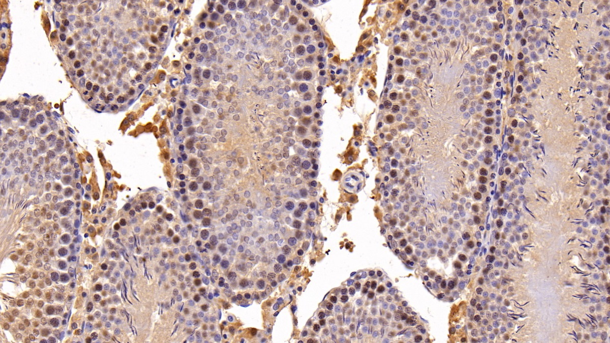 Polyclonal Antibody to Sirtuin 1 (SIRT1)