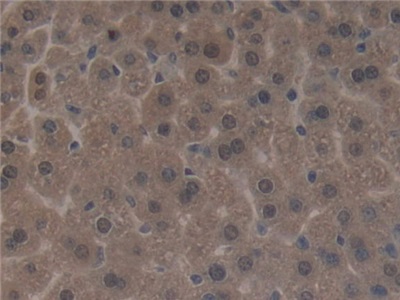 Polyclonal Antibody to Sirtuin 3 (SIRT3)