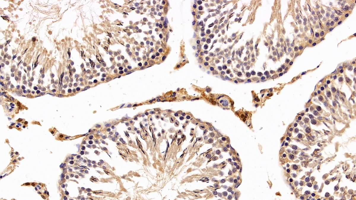 Polyclonal Antibody to Sirtuin 3 (SIRT3)