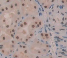 Polyclonal Antibody to Serine/Arginine Rich Splicing Factor 2 (SRSF2)