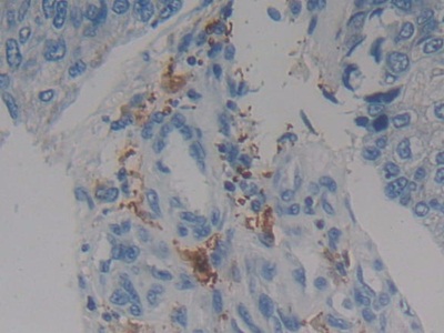 Polyclonal Antibody to 17-Beta-Hydroxysteroid Dehydrogenase Type 12 (HSD17b12)