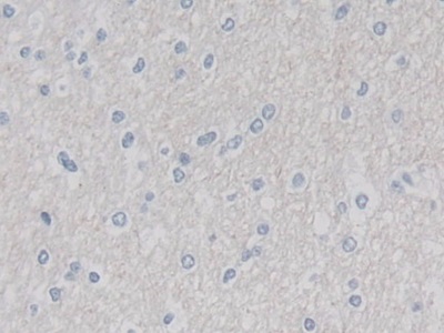 Polyclonal Antibody to Cullin 9 (CUL9)