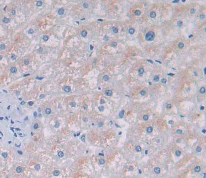 Polyclonal Antibody to Exocyst Complex Component 3 (EXOC3)