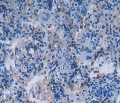 Polyclonal Antibody to Exocyst Complex Component 3 (EXOC3)