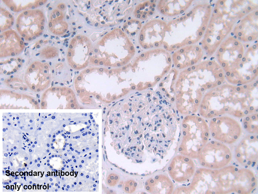 Polyclonal Antibody to Fatty Acid Desaturase 2 (FADS2)