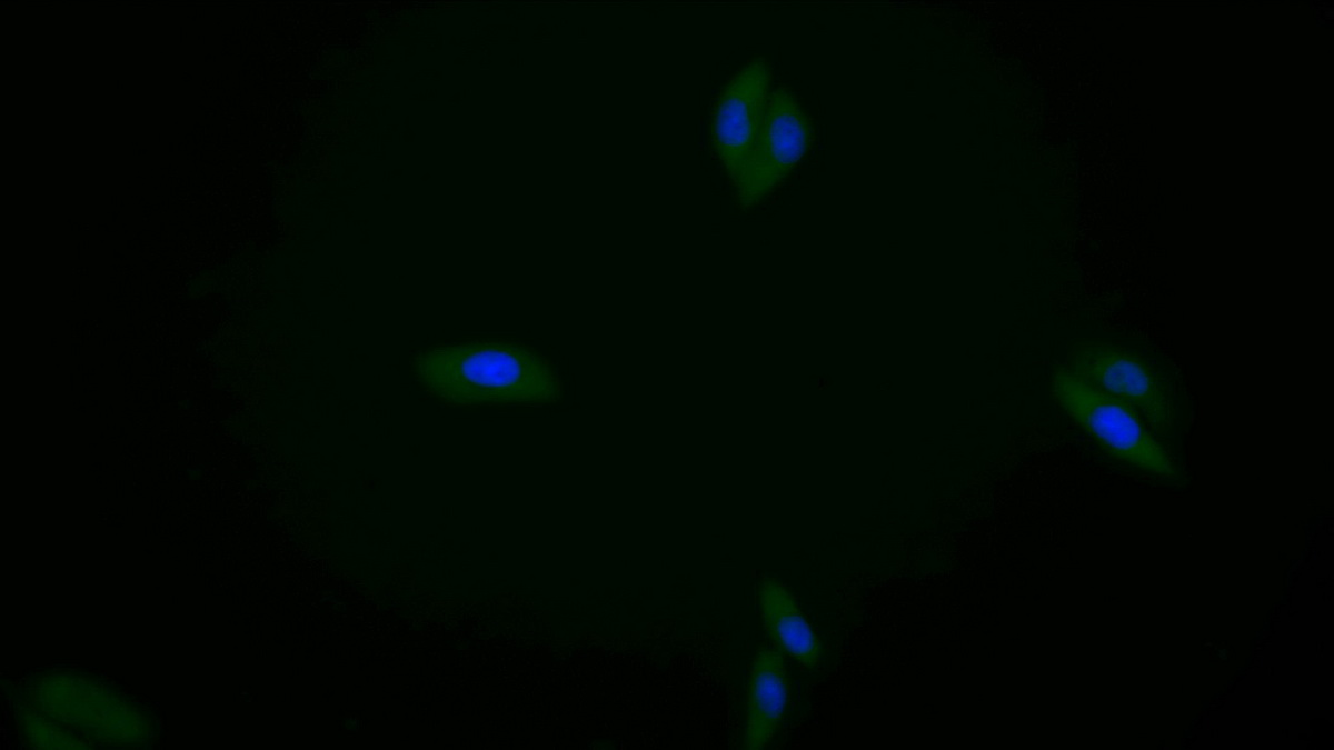 Polyclonal Antibody to Kinesin Family, Member 5A (KIF5A)