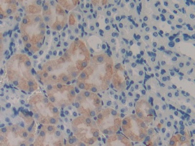 Polyclonal Antibody to Leukocyte Cell Derived Chemotaxin 2 (LECT2)