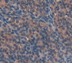 Polyclonal Antibody to Lysyl Oxidase Like Protein 1 (LOXL1)