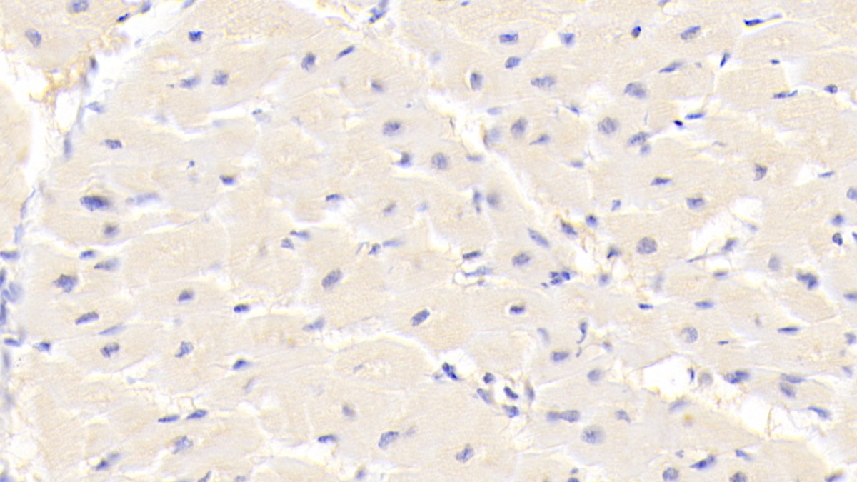 Polyclonal Antibody to Transient Receptor Potential Cation Channel Subfamily A, Member 1 (TRPA1)