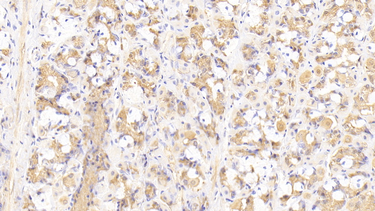 Polyclonal Antibody to Secretogranin II (SCG2)