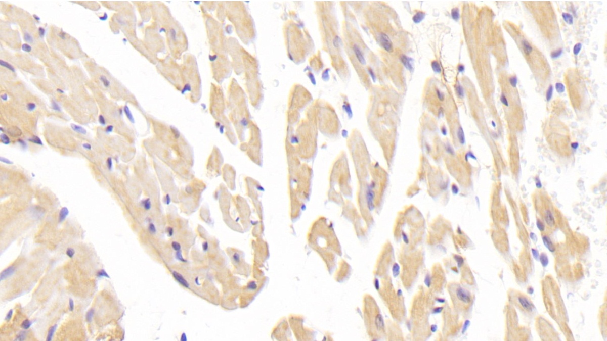 Polyclonal Antibody to Corin (CRN)