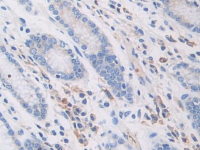 Polyclonal Antibody to Pregnancy Zone Protein (PZP)