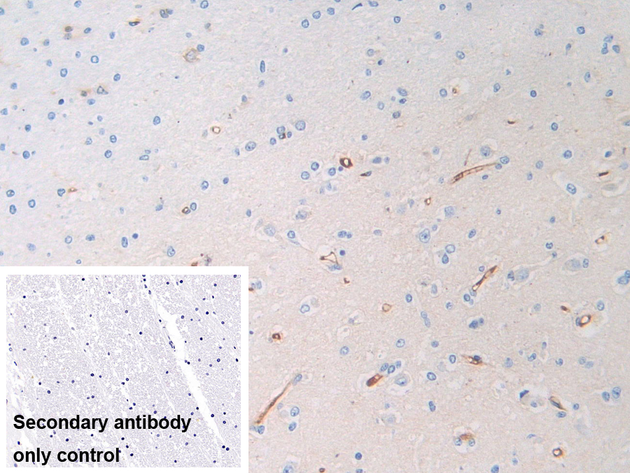 Polyclonal Antibody to Pregnancy Zone Protein (PZP)