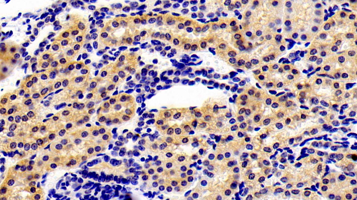 Polyclonal Antibody to ATPase, Ca++ Transporting, Cardiac Muscle, Slow Twitch 2 (ATP2A2)