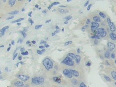 Polyclonal Antibody to Adenosylhomocysteinase (AHCY)