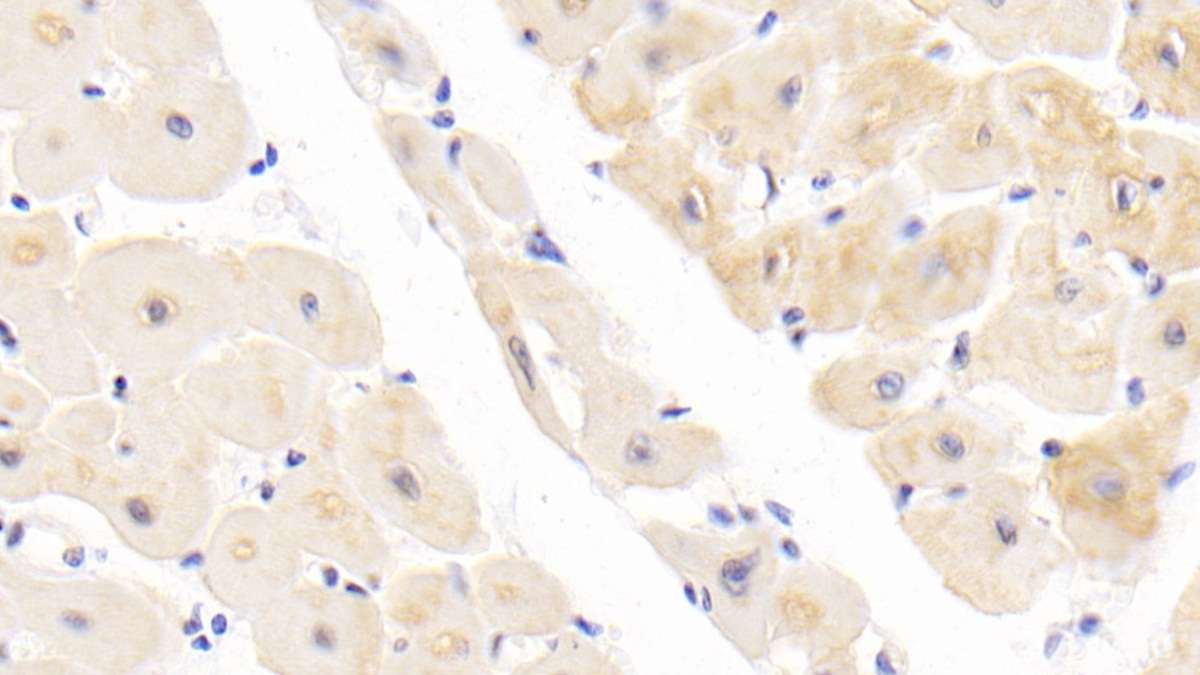 Polyclonal Antibody to Receptor Tyrosine Kinase Like Orphan Receptor 1 (ROR1)