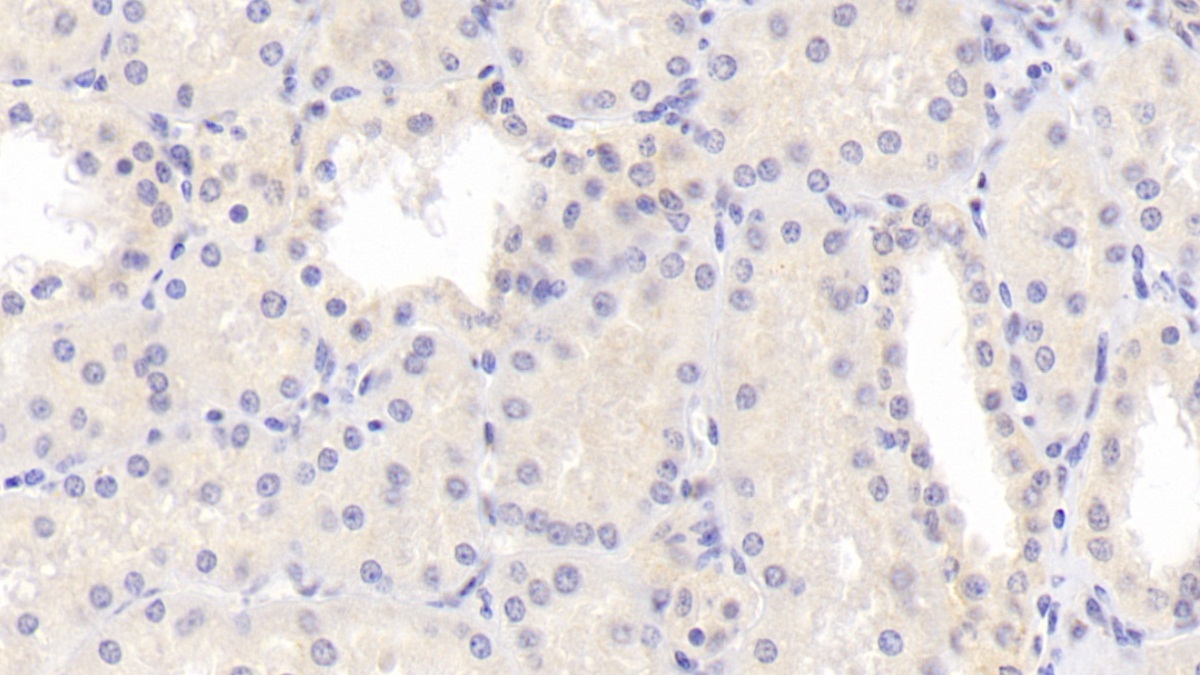 Polyclonal Antibody to Lysophosphatidylcholine Acyltransferase 1 (LPCAT1)