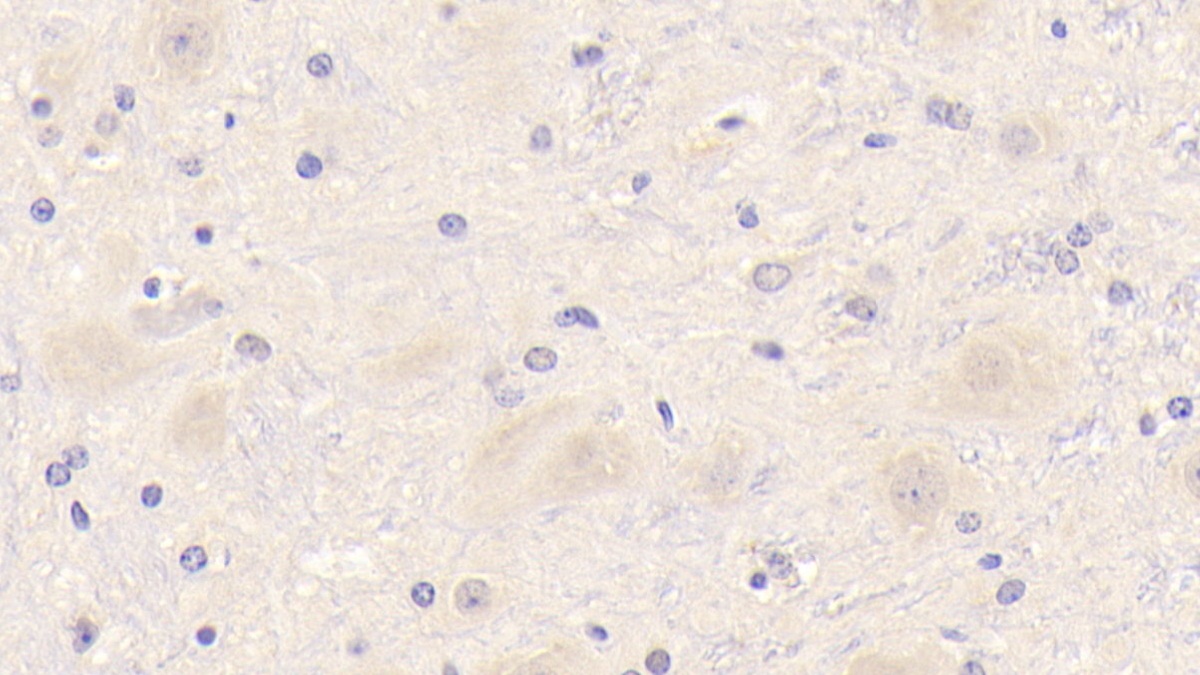 Polyclonal Antibody to Triggering Receptor Expressed On Myeloid Cells 2 (TREM2)