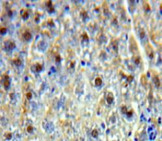 Polyclonal Antibody to Lens Epithelium Derived Growth Factor (LEDGF)