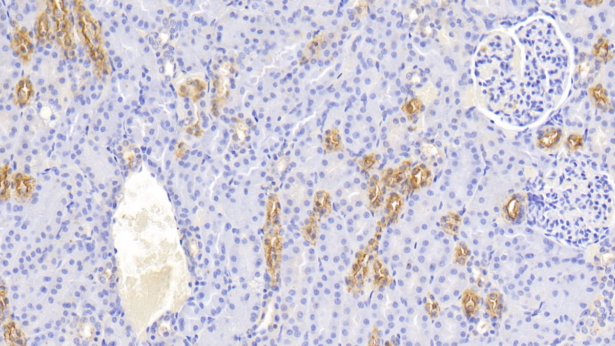 Polyclonal Antibody to Uromodulin (UMOD)