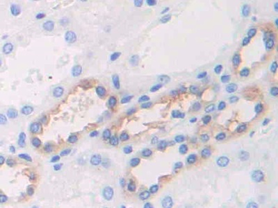 Polyclonal Antibody to Uromodulin (UMOD)