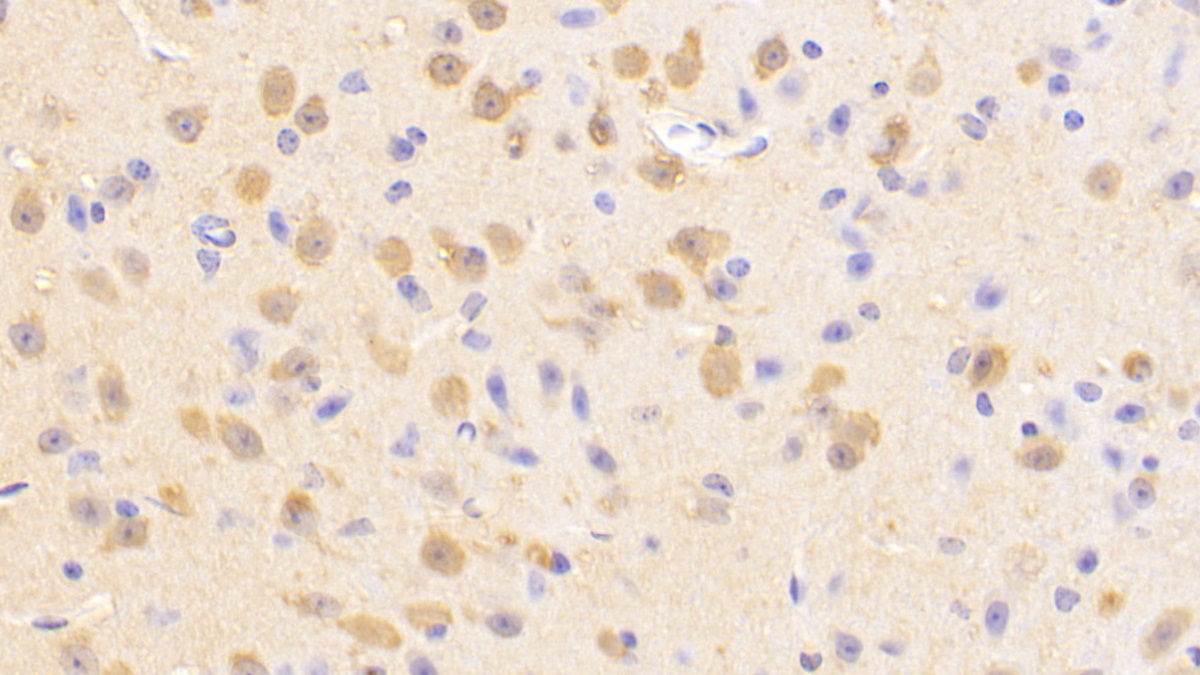 Polyclonal Antibody to Ubiquitin Carboxyl Terminal Hydrolase L1 (UCHL1)