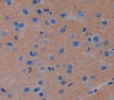 Polyclonal Antibody to Tumor Protein, Translationally Controlled 1 (TPT1)