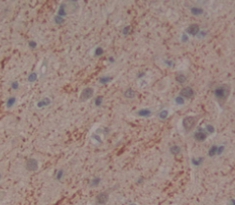 Polyclonal Antibody to Interferon Alpha 10 (IFNa10)