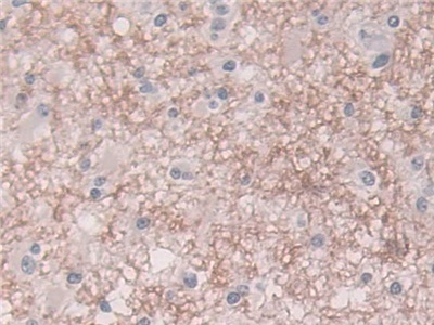 Polyclonal Antibody to Semenogelin I (SEMG1)
