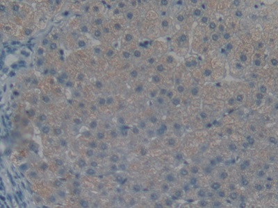 Polyclonal Antibody to Renal Tumor Antigen (RAGE)