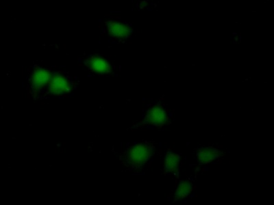 Polyclonal Antibody to Renal Tumor Antigen (RAGE)