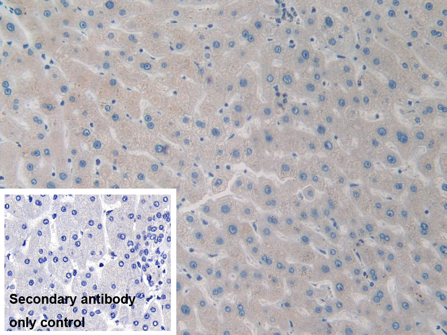 Polyclonal Antibody to Protein Phosphatase, Mg2+/Mn2+ Dependent 1A (PPM1A)